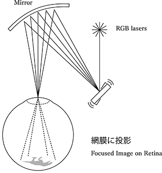 RETISSA図解資料